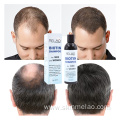 Biotin Hair Shampoo For Men And Women